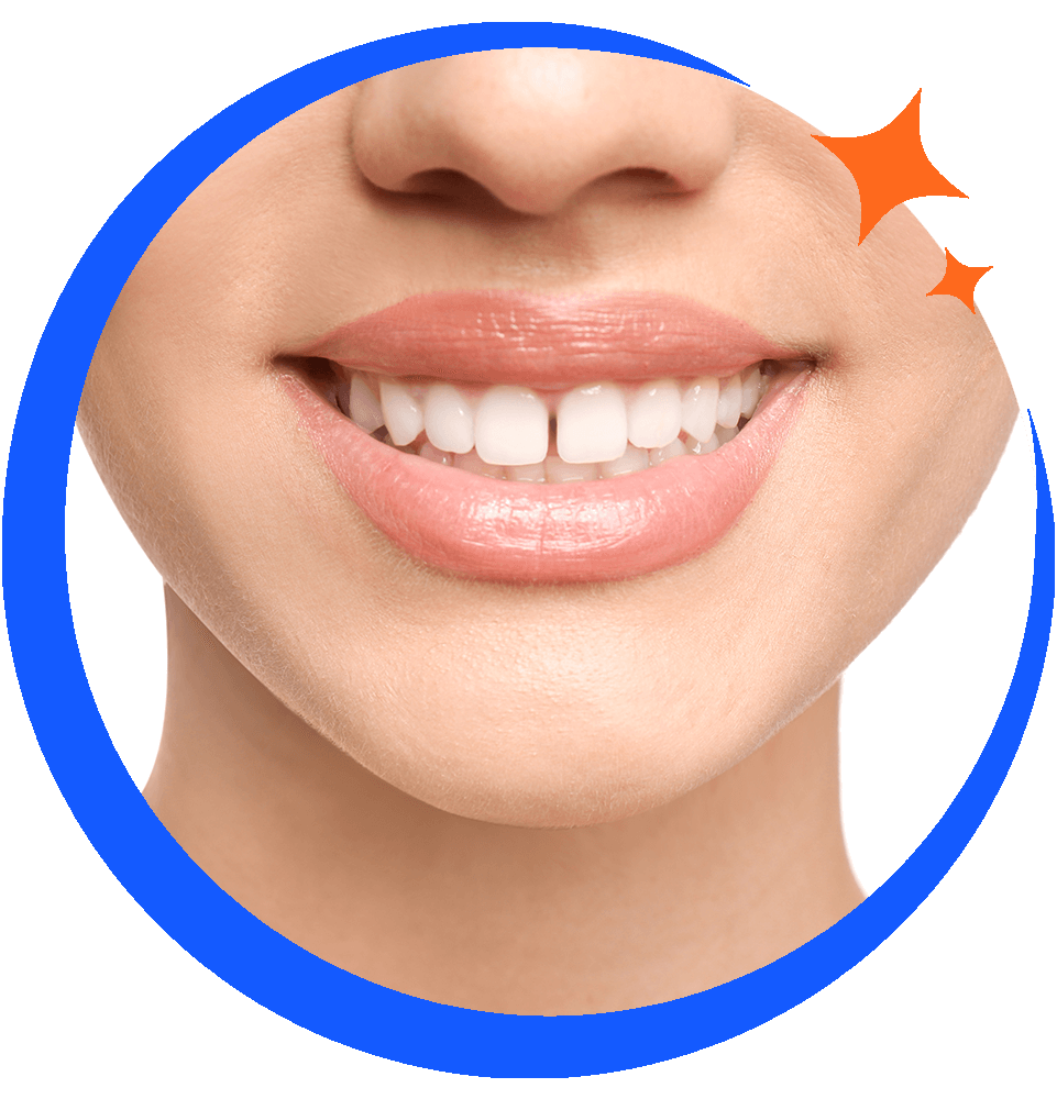 Porcelain Veneers Chicago, IL Brighter Smile